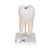 3B Scientific Lower Twin - Root Molar with Cavities Human Tooth Model, 2 Part - 3B Smart Anatomy