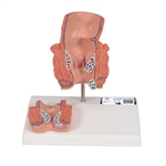 3B Scientific Hemorrhoid Model - 3B Smart Anatomy