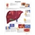 3B Scientific Hepatitis Chart (Laminated)