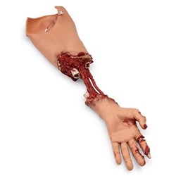 Nasco Simulaids Xtreme Trauma Bleeding Arm for Advanced Smart Stat