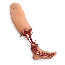 Nasco Simulaids Xtreme Trauma Bleeding Leg Moulage for Stat Simulators