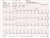 EKG Paper for Schiller Cardiovit MS-2015 - 1 Case of 10 Packs