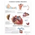 3B Scientific Common Cardiac Disorders Chart (Non Laminated)