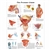 3B Scientific The Prostate Gland Chart (Non Laminated)