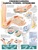 Understanding Carpal Tunnel Syndrome Anatomical Chart