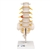 3B Scientific Human Lumbar Spinal Column Model with Dorso-Lateral Prolapsed Intervertebral Disc Smart Anatomy