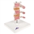 3B Scientific Deluxe Human Osteoporosis Model (3 Vertebrae with Discs ), Removable on Stand Smart Anatomy