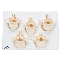 3B Scientific Set of 5 Bonelike Lumbar Vertebrae Smart Anatomy