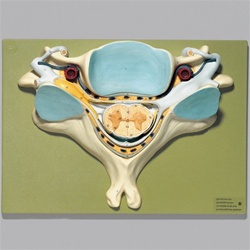 Fifth Cervical Vertebra