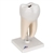 3B Scientific Lower Twin-Root Molar with Cavities Human Tooth Model, 2 Part Smart Anatomy