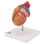 3B Scientific Classic Human Heart Model with Left Ventricular Hypertrophy (LVH), 2 Part Smart Anatomy