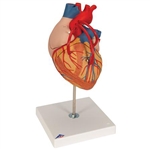 3B Scientific Human Heart Model with Bypass, 2 Times Life-Size, 4 Part Smart Anatomy