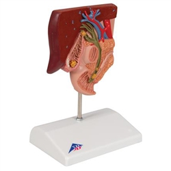 3B Scientific Gallstone Model Smart Anatomy