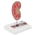 3B Scientific Kidney Stone Model Smart Anatomy