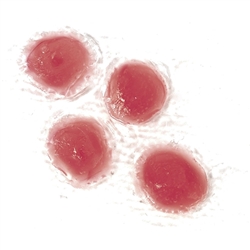 Nasco Life or Form Chicken Pox (Varicella) Blisters