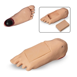 Nasco Life or Form GERi or KERi Optional Edema Foot with Deep Tissue Injury - Light