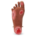 Nasco Life or Form GERi or KERi Optional Pressure Injury Foot - Medium