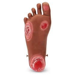 Nasco Life or Form GERi or KERi Optional Pressure Injury Foot - Medium