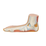 3B Scientific Flat Foot (Pes Planus) Model Smart Anatomy