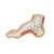 3B Scientific Hollow Foot (Pes Cavus) Model Smart Anatomy