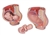 MEDart™ Pregnancy Pelvis