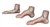MEDart™ Foot Series (Normal, Flat and Hollow Feet)