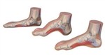 MEDart™ Foot Series (Normal, Flat and Hollow Feet)