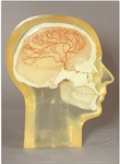 RSD Half Angiographic Head Phantom with Step Wedge