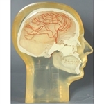 RSD Transparent Half Angiographic Head Phantom with Step Wedge