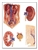 3B Scientific The Kidney Chart