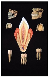 3B Scientific Healthy Denture Chart