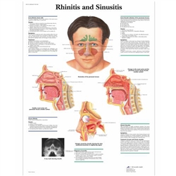 3B Scientific Rhinitis and Sinusitis Chart