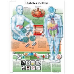 3B Scientific Diabetes Mellitus Chart