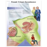 3B Scientific Female Urinary Incontinence Chart