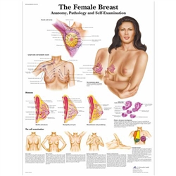 3B Scientific Female Breast Chart, Anatomy, Pathology and Self-Examination