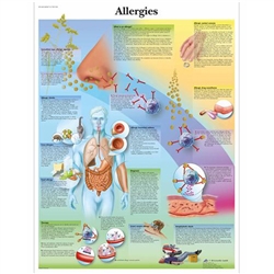 3B Scientific Allergies Chart