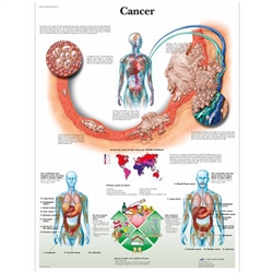 3B Scientific Cancer Chart