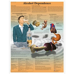 3B Scientific Alcohol Dependence Chart