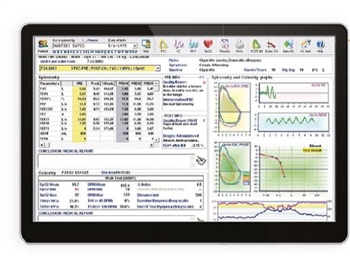 Winspiro PRO NET Software (Winspiro PRO network version)