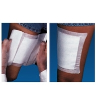 WoundGard Adhesive Dressing 6 X Inch Gauze Square White Sterile, MP00096C - ONE DRESSING