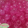 20mm Hot Pink Fizzy Bubblegum Bead