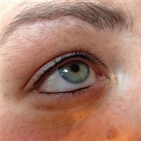 Eyelash enhancement
