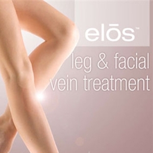 Laser Vein Treatment