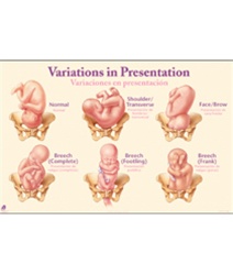 Variations in Presentation Chart