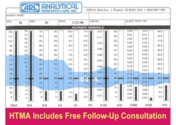 Hair Tissue Mineral Analysis Test Results