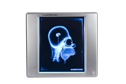 <b>X-Ray Film Illuminator LED - Single Bank</b>