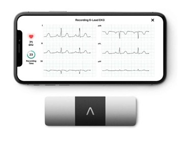 KardiaMobile 6L EKG l Wireless 6-Lead EKG