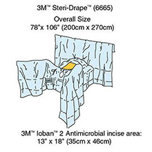 3M IOBAN 2 Abdominal Perineal Drape, 78" x 106", Lithotomy Position. MFID: 6665