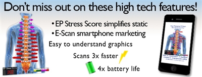 Feature Pack B (E-Scan + EP Stress Score) Download