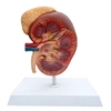 Kidney Model & Adrenal Gland 3x Life Size